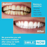 لصقات تبييض الاسنان سمايل ناو 14 يوم - SMILE:NOW Teeth Whitening Strips