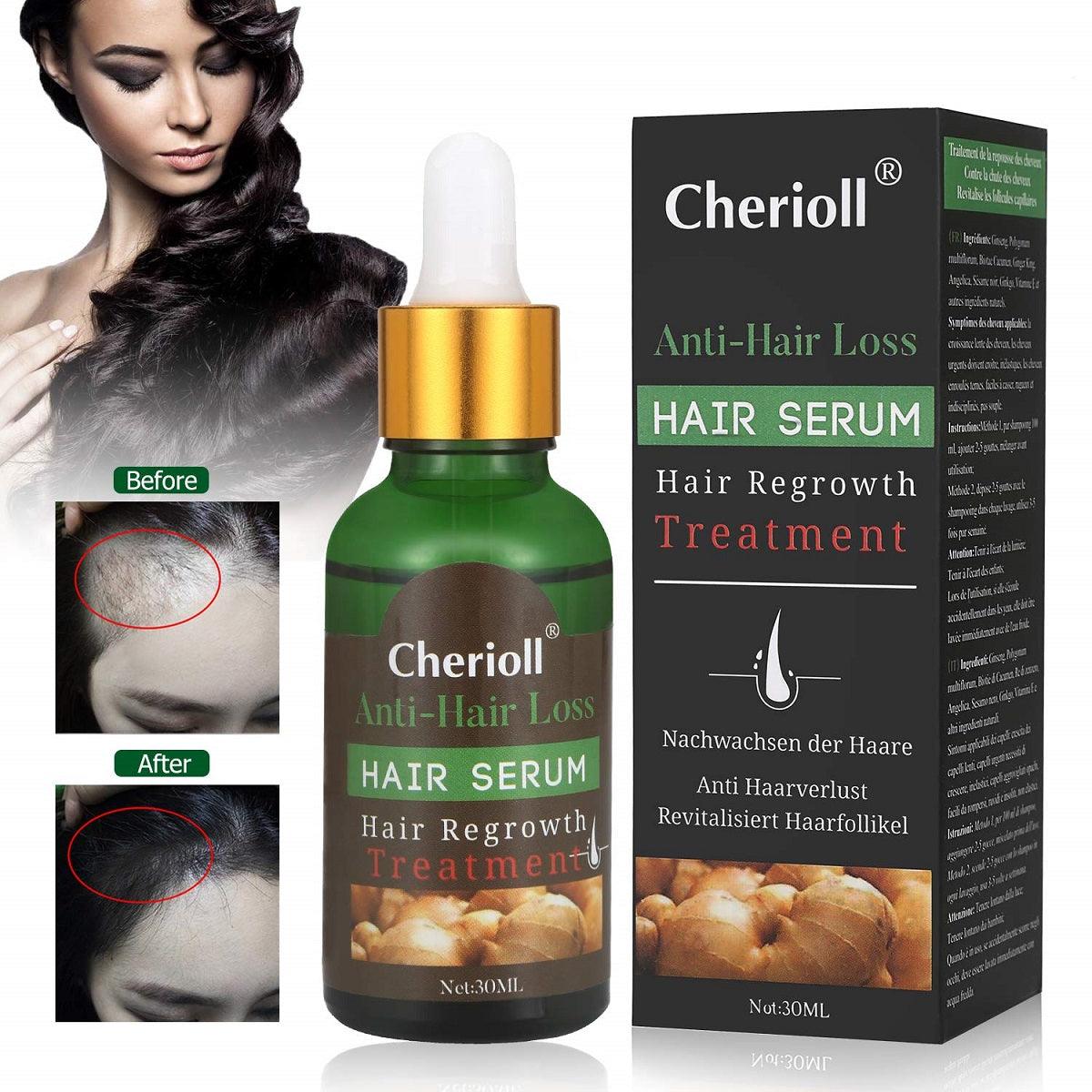 Cherioll Hair Regrowth Treatment, 30 ml